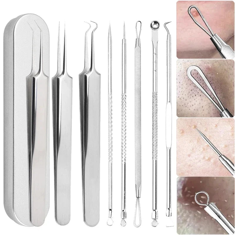 7/10Pcs Pore Prep Tool Skin Scraping Acne Treatment Kit Blackhead Removal