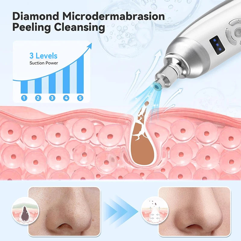 Protable Diamond Microdermabrasion Machine Removal Facial Beauty Device for Acne Scars