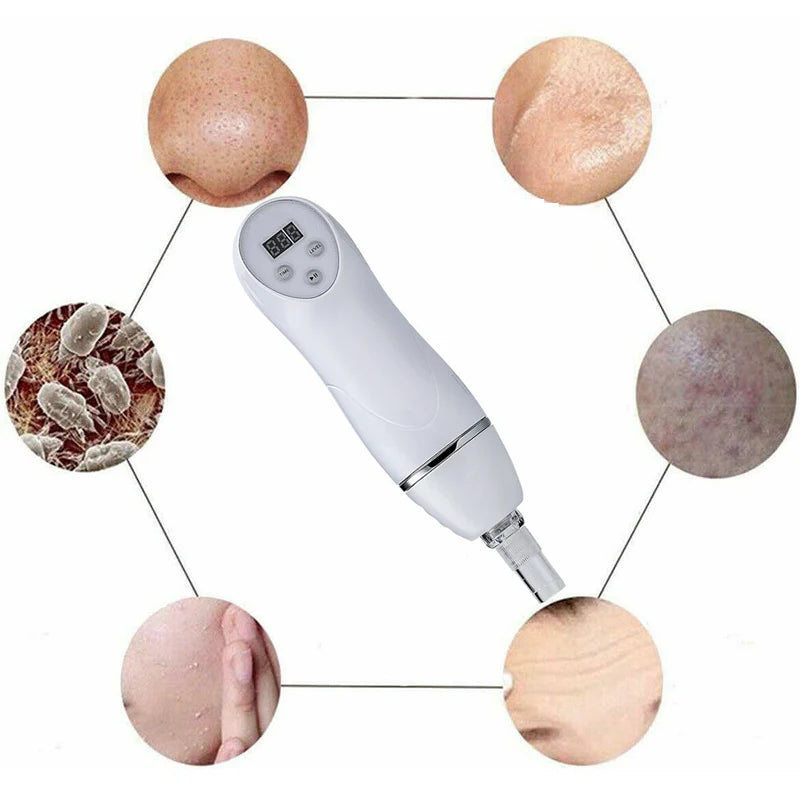 Home Use Blackhead Acne Removal Beauty Device Microdermabrasion