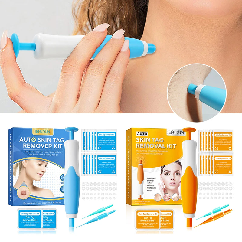 Rubber Rings Skin Tag Removal Tool Face Beauty Accessories Skin Tag Removal