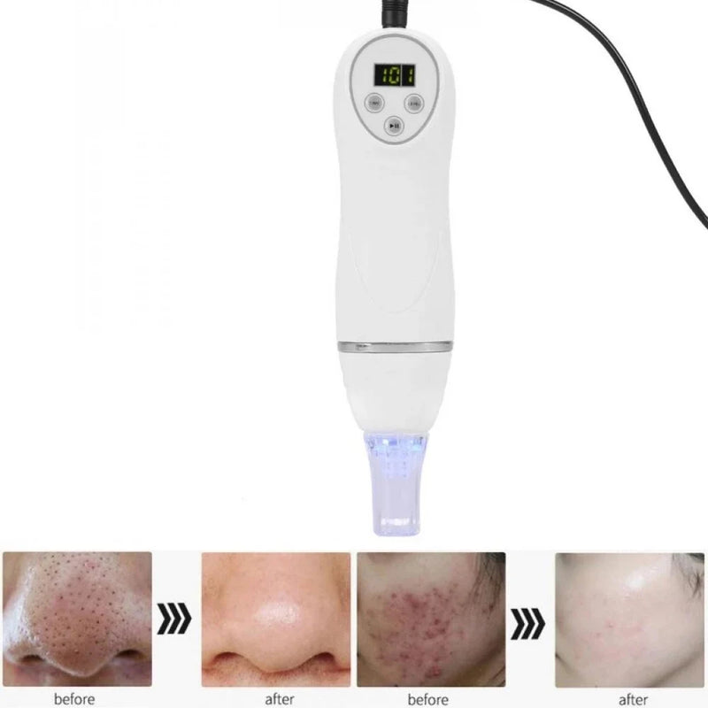 Home Use Blackhead Acne Removal Beauty Device Microdermabrasion