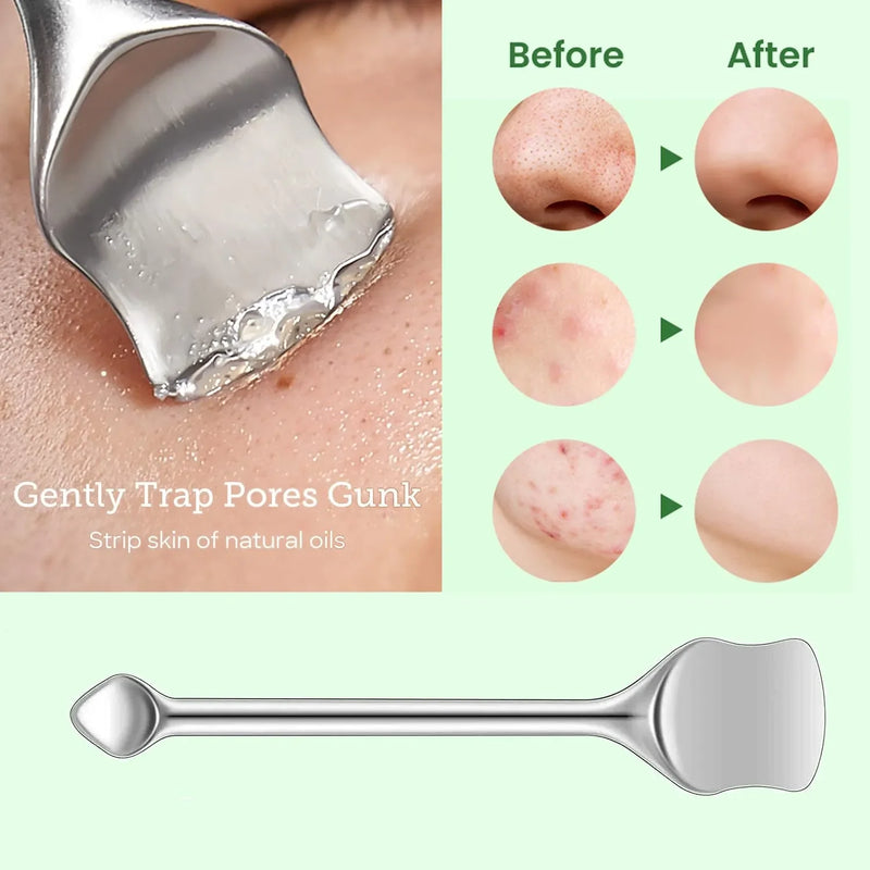 7/10Pcs Pore Prep Tool Skin Scraping Acne Treatment Kit Blackhead Removal