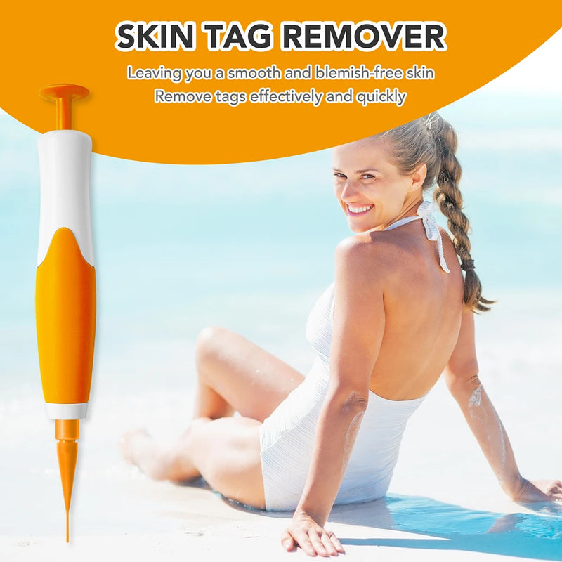 Rubber Rings Skin Tag Removal Tool Face Beauty Accessories Skin Tag Removal