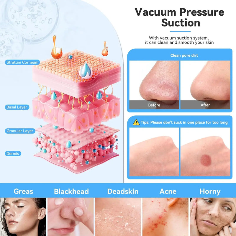 Protable Diamond Microdermabrasion Machine Removal Facial Beauty Device for Acne Scars